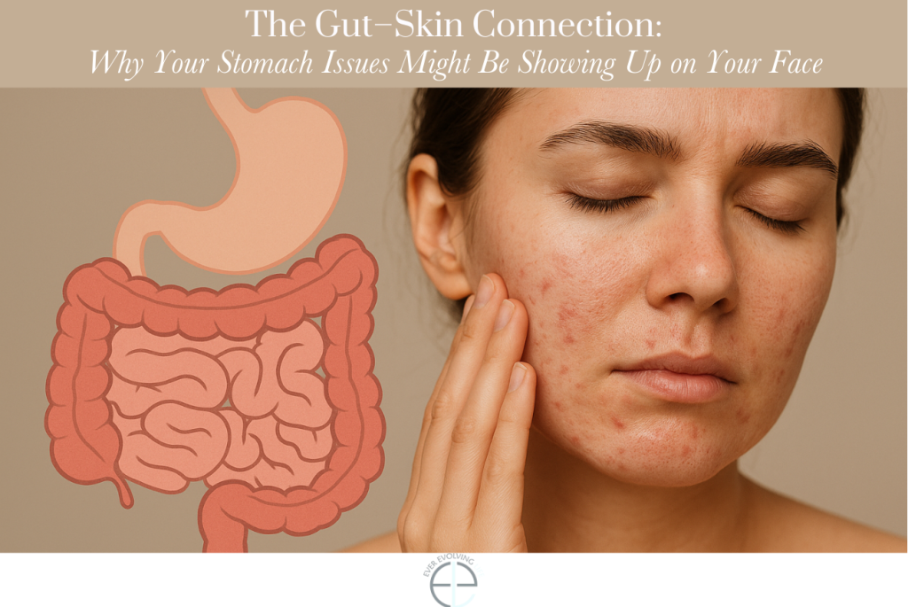 The Gut–Skin Connection: Why Your Stomach Issues Might Be Showing Up on Your Face